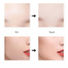 PureSkin™ | Voor een stralende en frisse huid