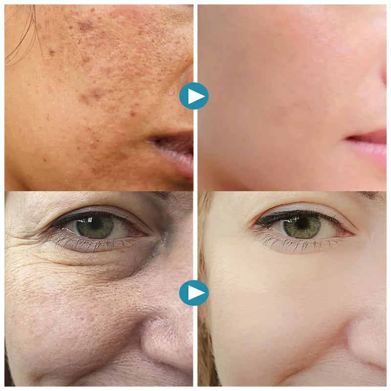 PureSkin™ | Voor een stralende en frisse huid